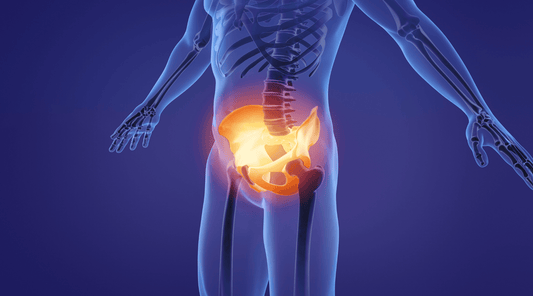3D-Darstellung eines menschlichen Skeletts mit hervorgehobenem Beckenbereich, mögliche Darstellung von Beckenschiefstand oder Hüftproblemen.