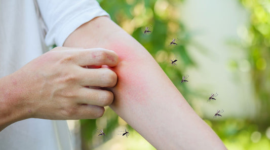 Person kratzt entzündeten Mückenstich am Arm, umgeben von fliegenden Mücken – typisches Sommerproblem